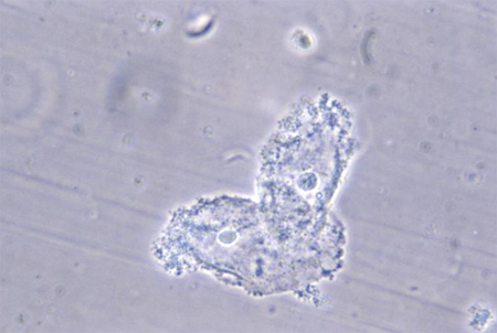 Evaluation of recurrent miscarriage images
