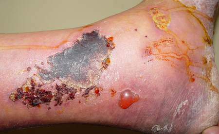 com.bmj.content.model.Caption@54b4e837