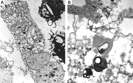 com.bmj.content.model.Caption@175b0fe