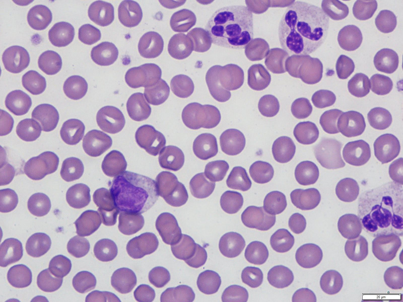 com.bmj.content.model.assessment.Caption@428a9c59