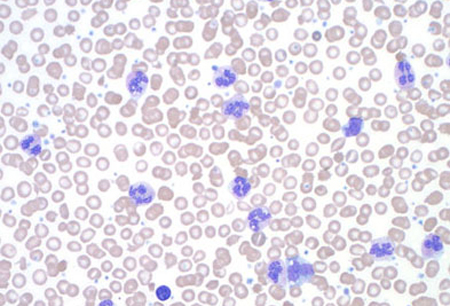 com.bmj.content.model.assessment.Caption@5788800a