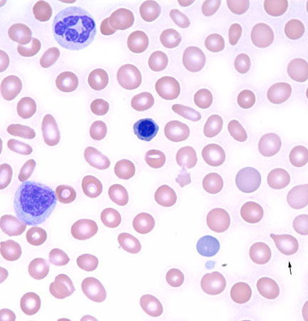 com.bmj.content.model.assessment.Caption@7cbfeb10