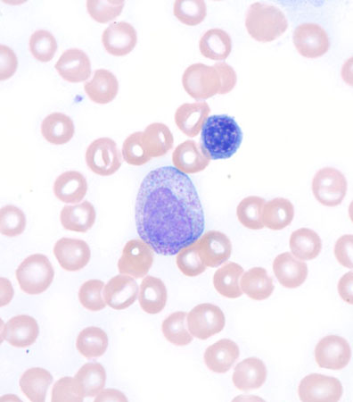 com.bmj.content.model.assessment.Caption@10d573f7