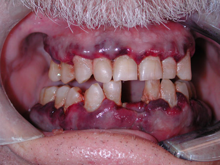 com.bmj.content.model.assessment.Caption@530b651b