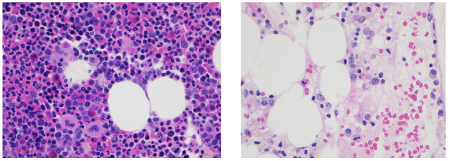 com.bmj.content.model.assessment.Caption@5bbf2f77