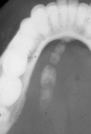 com.bmj.content.model.Caption@1288a8d5