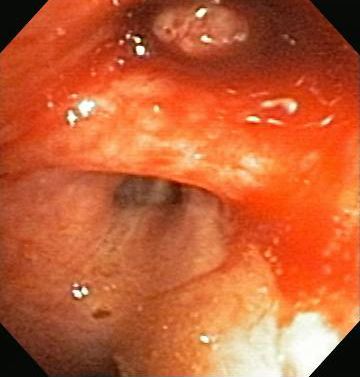 com.bmj.content.model.assessment.Caption@6f4fd680