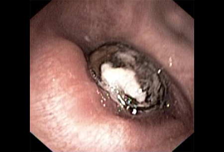 com.bmj.content.model.assessment.Caption@6a0052eb