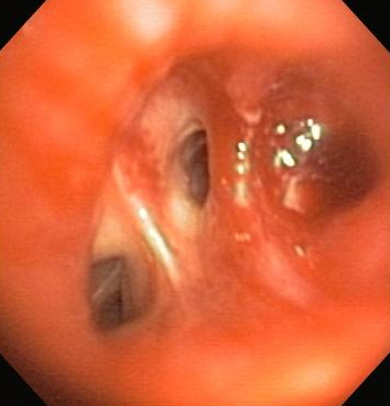 com.bmj.content.model.assessment.Caption@62f45019