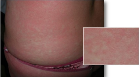 com.bmj.content.model.assessment.Caption@40f2e07e