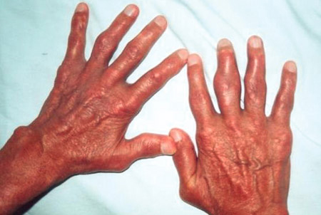 com.bmj.content.model.assessment.Caption@2258903a