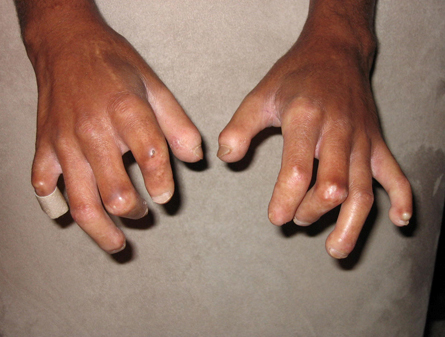 com.bmj.content.model.assessment.Caption@1263625f