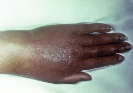 com.bmj.content.model.assessment.Caption@7012b64d