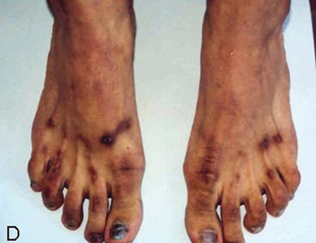 com.bmj.content.model.assessment.Caption@559307c4
