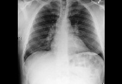 com.bmj.content.model.assessment.Caption@401fc226