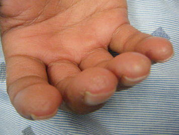 com.bmj.content.model.assessment.Caption@306cf0b8