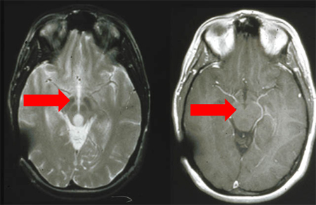 com.bmj.content.model.assessment.Caption@40d13863