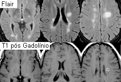 com.bmj.content.model.assessment.Caption@d111eeb