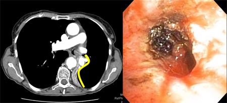com.bmj.content.model.Caption@3d868106