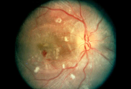 com.bmj.content.model.assessment.Caption@782e307e