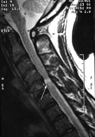 com.bmj.content.model.assessment.Caption@63960ae