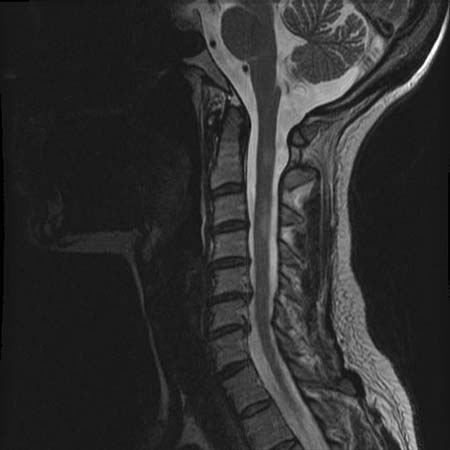 com.bmj.content.model.assessment.Caption@67b1b99