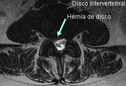 com.bmj.content.model.assessment.Caption@3a697e04