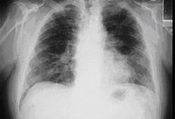 com.bmj.content.model.assessment.Caption@565a451d