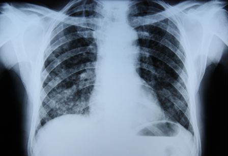 com.bmj.content.model.assessment.Caption@35d14aca
