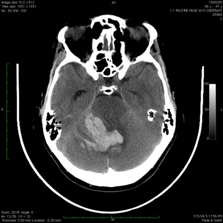 com.bmj.content.model.assessment.Caption@7558d645