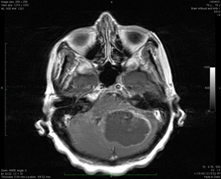 com.bmj.content.model.assessment.Caption@28d68fc7