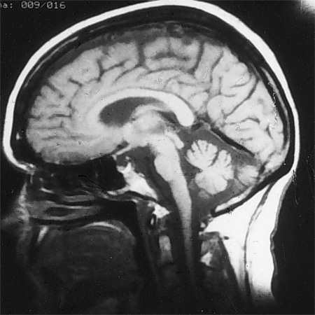 com.bmj.content.model.assessment.Caption@4300cb13