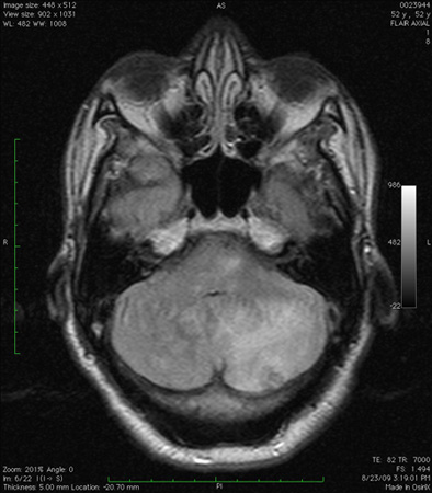 com.bmj.content.model.assessment.Caption@754e7ab7