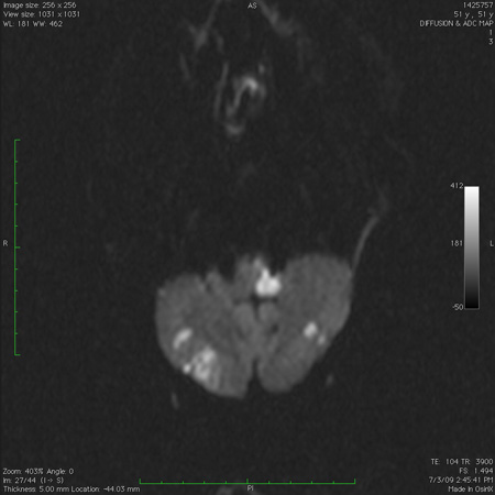 com.bmj.content.model.assessment.Caption@7e373160