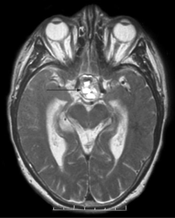 com.bmj.content.model.assessment.Caption@3276f324