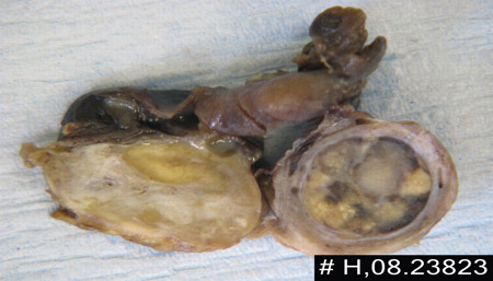 com.bmj.content.model.assessment.Caption@588ca0d3