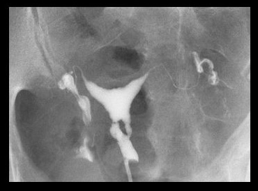 com.bmj.content.model.assessment.Caption@30590dd6