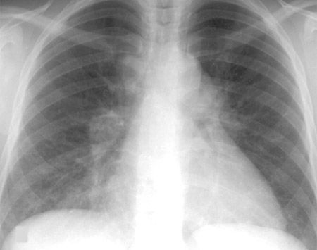 com.bmj.content.model.Caption@2c8fb86b