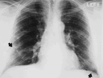 com.bmj.content.model.Caption@4d590662