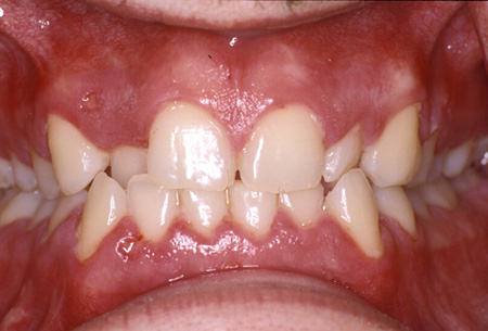 com.bmj.content.model.assessment.Caption@8c39991