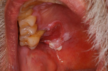 com.bmj.content.model.assessment.Caption@60fb87df