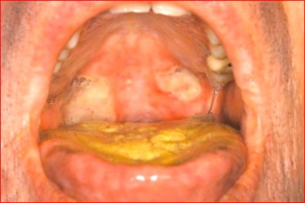 com.bmj.content.model.assessment.Caption@643d0742