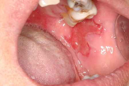 com.bmj.content.model.assessment.Caption@6ef305f6
