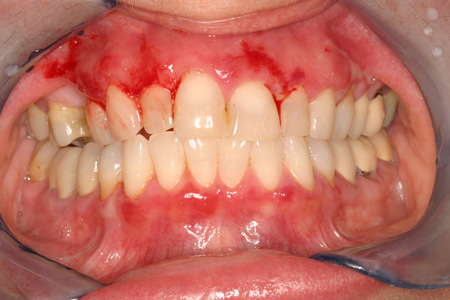 com.bmj.content.model.assessment.Caption@3fc5f009