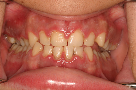com.bmj.content.model.assessment.Caption@28460bd0
