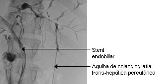 com.bmj.content.model.assessment.Caption@46e47a9