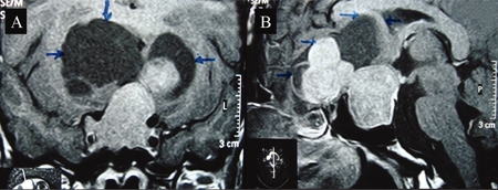 com.bmj.content.model.assessment.Caption@47139321