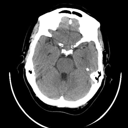 com.bmj.content.model.assessment.Caption@59d1fe6c