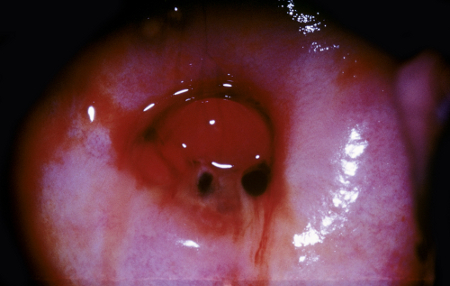 com.bmj.content.model.assessment.Caption@49630ada