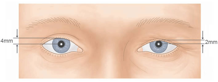 com.bmj.content.model.assessment.Caption@59a68511